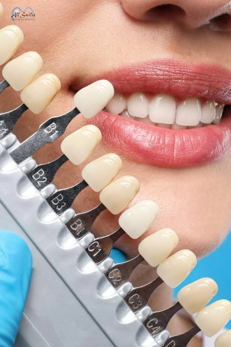 Cosmetic dentistry smile transformation
